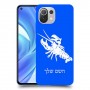 סרטן כיסוי מגן קשיח בעיצוב אישי עם השם שלך ל Xiaomi Mi 11 Lite יחידה אחת סקרין מובייל