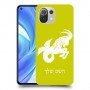 גדי כיסוי מגן קשיח בעיצוב אישי עם השם שלך ל Xiaomi Mi 11 Lite יחידה אחת סקרין מובייל