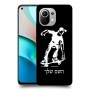 ילד סקייטבורד כיסוי מגן קשיח בעיצוב אישי עם השם שלך ל Xiaomi Mi 11 יחידה אחת סקרין מובייל