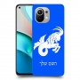 גדי כיסוי מגן קשיח בעיצוב אישי עם השם שלך ל Xiaomi Mi 11 יחידה אחת סקרין מובייל