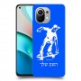 ילד סקייטבורד כיסוי מגן קשיח בעיצוב אישי עם השם שלך ל Xiaomi Mi 11 יחידה אחת סקרין מובייל