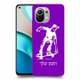 ילד סקייטבורד כיסוי מגן קשיח בעיצוב אישי עם השם שלך ל Xiaomi Mi 11 יחידה אחת סקרין מובייל