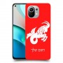 גדי כיסוי מגן קשיח בעיצוב אישי עם השם שלך ל Xiaomi Mi 11 יחידה אחת סקרין מובייל