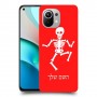 שלד כיסוי מגן קשיח בעיצוב אישי עם השם שלך ל Xiaomi Mi 11 יחידה אחת סקרין מובייל