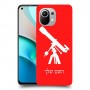 טלסקופ כיסוי מגן קשיח בעיצוב אישי עם השם שלך ל Xiaomi Mi 11 יחידה אחת סקרין מובייל