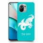 גדי כיסוי מגן קשיח בעיצוב אישי עם השם שלך ל Xiaomi Mi 11 יחידה אחת סקרין מובייל