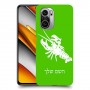 סרטן כיסוי מגן קשיח בעיצוב אישי עם השם שלך ל Xiaomi Poco F3 יחידה אחת סקרין מובייל
