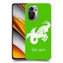 גדי כיסוי מגן קשיח בעיצוב אישי עם השם שלך ל Xiaomi Poco F3 יחידה אחת סקרין מובייל
