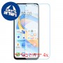 [4 יחידות] Honor X7b 5G (50 MP)  מגן מסך הידרוג'ל פרטיות (סיליקון) סקרין מובייל