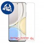 [4 יחידות] Honor X9 מגן מסך הידרוג'ל פרטיות (סיליקון) סקרין מובייל