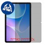 [2 יחידות] Infinix Xpad 20  מגן מסך הידרוג'ל פרטיות (סיליקון) סקרין מובייל