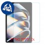 [2 יחידות] Infinix Xpad  מגן מסך הידרוג'ל פרטיות (סיליקון) סקרין מובייל