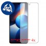 [4 יחידות] Infinix Zero 20 מגן מסך הידרוג'ל שקוף (סיליקון) סקרין מובייל