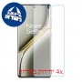 [4 יחידות] OnePlus Ace 3 Pro  מגן מסך הידרוג'ל פרטיות (סיליקון) סקרין מובייל