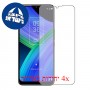 [4 יחידות] TCL 20 R 5G מגן מסך הידרוג'ל פרטיות (סיליקון) סקרין מובייל