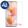 [4 יחידות] Xiaomi Civi 1S מגן מסך הידרוג'ל פרטיות (סיליקון) סקרין מובייל