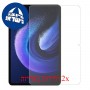 [2 יחידות] Xiaomi Pad 6 מגן מסך נאנו זכוכית 9H פרטיות סקרין מובייל