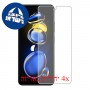 [4 יחידות] Xiaomi Redmi Note 11T Pro מגן מסך נאנו זכוכית 9H פרטיות סקרין מובייל