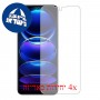 [4 יחידות] Xiaomi Redmi Note 12 מגן מסך נאנו זכוכית 9H פרטיות סקרין מובייל