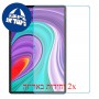 [2 יחידות] Lenovo Pad Pro מגן מסך נאנו זכוכית 9H סקרין מובייל