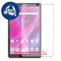 [2 יחידות] Lenovo Tab M8 (3rd Gen) מגן מסך הידרוג'ל שקוף (סיליקון) סקרין מובייל