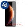 [4 יחידות] Infinix Zero X Neo מגן מסך הידרוג'ל שקוף (סיליקון) סקרין מובייל