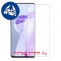 [4 יחידות] OnePlus 9RT 5G מגן מסך הידרוג'ל שקוף (סיליקון) סקרין מובייל