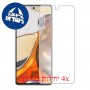 [4 יחידות] Xiaomi 11T Pro מגן מסך הידרוג'ל שקוף (סיליקון) סקרין מובייל