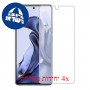 [4 יחידות] Xiaomi 11T מגן מסך הידרוג'ל שקוף (סיליקון) סקרין מובייל