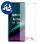 [4 יחידות] Infinix Note 11 Pro מגן מסך נאנו זכוכית 9H סקרין מובייל