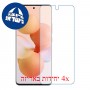 [4 יחידות] Xiaomi Civi מגן מסך נאנו זכוכית 9H סקרין מובייל