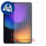 [2 יחידות] Xiaomi Pad 7 מגן מסך הידרוג'ל שקוף (סיליקון) סקרין מובייל