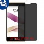 [4 יחידות] LG X Skin מגן מסך הידרוג'ל פרטיות (סיליקון) סקרין מובייל