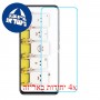 [4 יחידות] ZTE Axon 20 5G מגן מסך נאנו זכוכית 9H סקרין מובייל