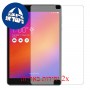 [2 יחידות] Asus Zenpad Z10 ZT500KL מגן מסך הידרוג'ל שקוף (סיליקון) סקרין מובייל