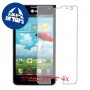 [4 יחידות] LG Optimus F3 מגן מסך הידרוג'ל שקוף (סיליקון) סקרין מובייל