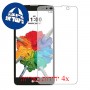 [4 יחידות] LG Stylus 2 Plus מגן מסך הידרוג'ל שקוף (סיליקון) סקרין מובייל
