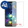 [4 יחידות] LG V50 ThinQ 5G מגן מסך הידרוג'ל שקוף (סיליקון) סקרין מובייל