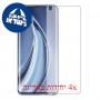 [4 יחידות] Xiaomi Mi 10 Pro 5G מגן מסך הידרוג'ל שקוף (סיליקון) סקרין מובייל