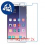 [2 יחידות] Coolpad Cool1 dual מגן מסך נאנו זכוכית 9H סקרין מובייל