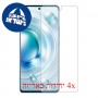 [4 יחידות] vivo X80 מגן מסך הידרוג'ל פרטיות (סיליקון) סקרין מובייל